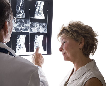 Post image for Spinal Stenosis Symptoms and Treatment Options