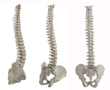 Post image for Spinal Stenosis Can Be a Disabling Medical Condition